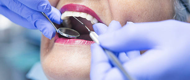 Best Emergency Tooth Extraction  in Helena Flats, MT